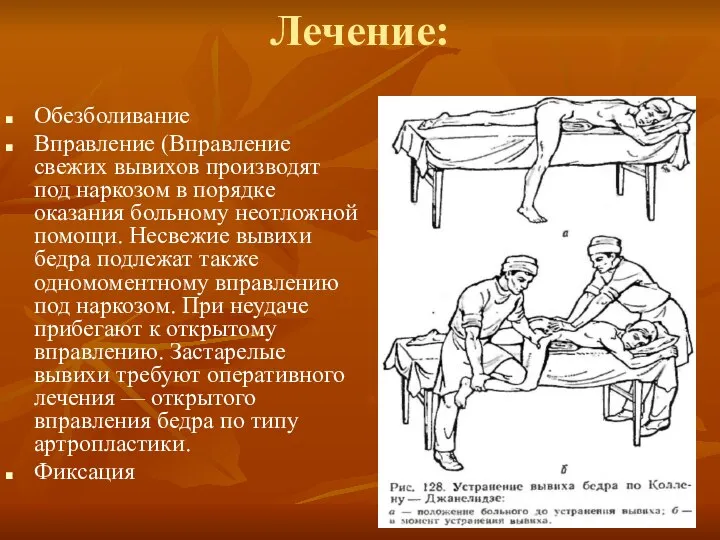 Лечение: Обезболивание Вправление (Вправление свежих вывихов производят под наркозом в порядке