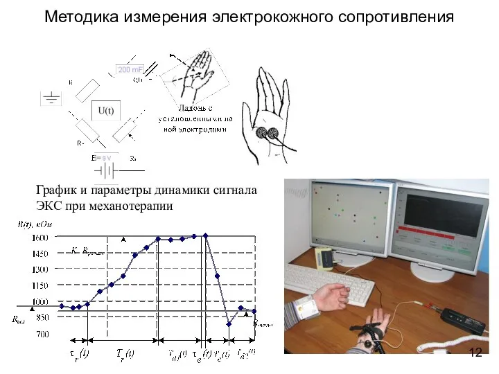 Методика измерения электрокожного сопротивления График и параметры динамики сигнала ЭКС при механотерапии 12