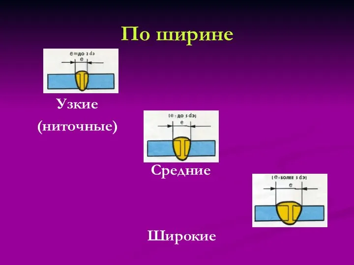 Узкие (ниточные) Средние Широкие По ширине