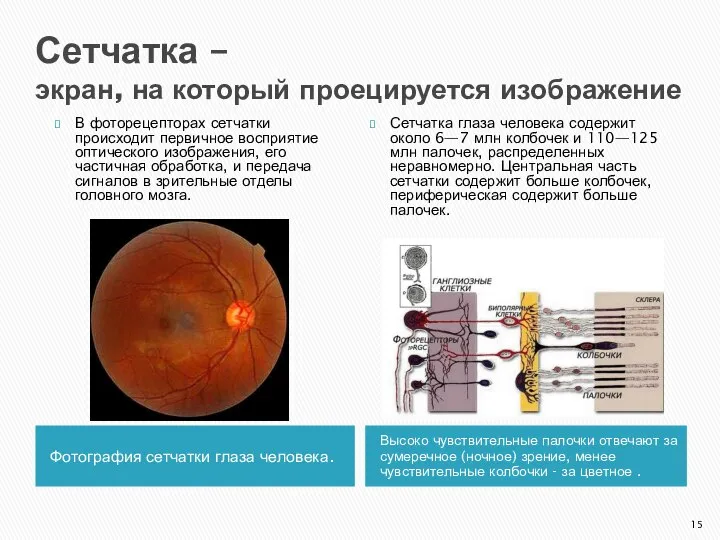 Сетчатка – экран, на который проецируется изображение Фотография сетчатки глаза человека.