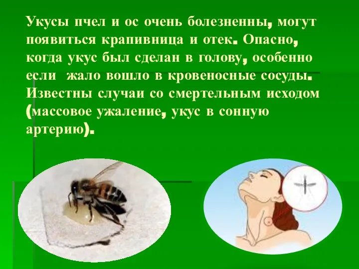 Укусы пчел и ос очень болезненны, могут появиться крапивница и отек.