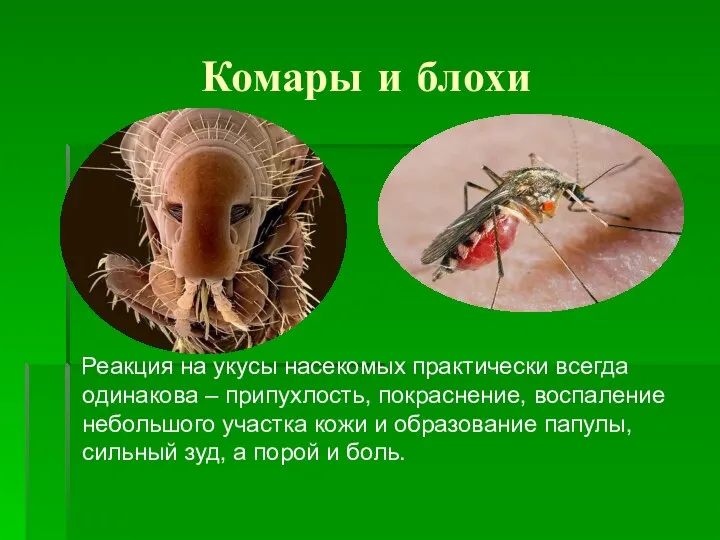 Комары и блохи Реакция на укусы насекомых практически всегда одинакова –