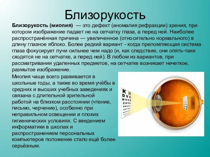 Близорукость Близорукость (миопия) — это дефект (аномалия рефракции) зрения, при котором