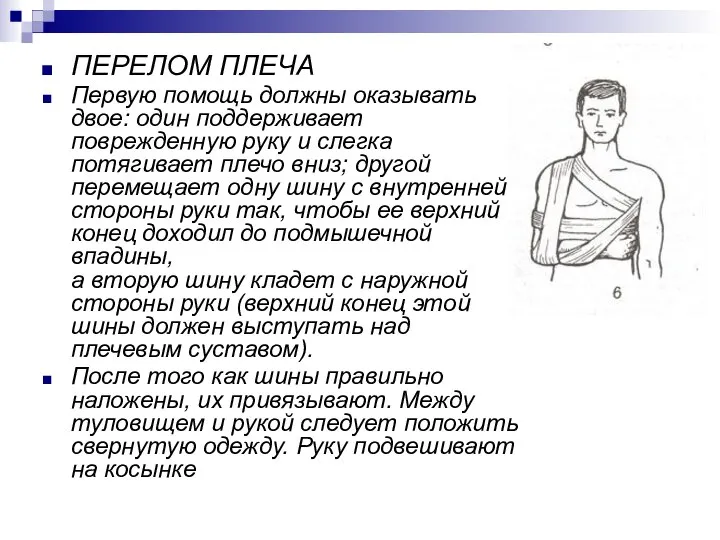 ПЕРЕЛОМ ПЛЕЧА Первую помощь должны оказывать двое: один поддерживает поврежденную руку