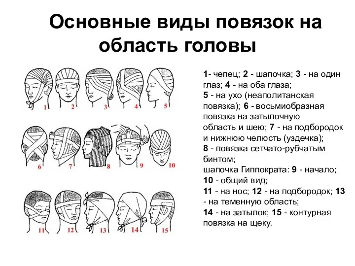 Основные виды повязок на область головы 1- чепец; 2 - шапочка;