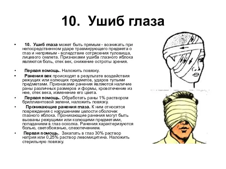 10. Ушиб глаза 10. Ушиб глаза может быть прямым - возникать