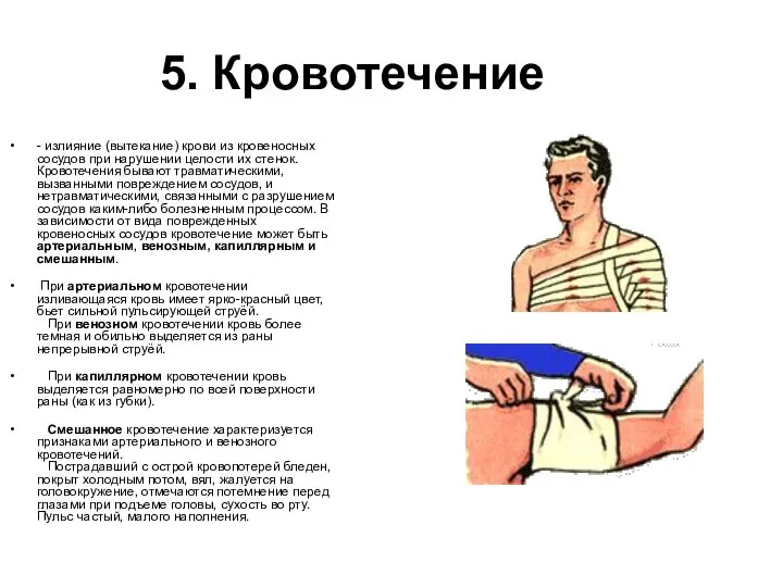 5. Кровотечение - излияние (вытекание) крови из кровеносных сосудов при нарушении