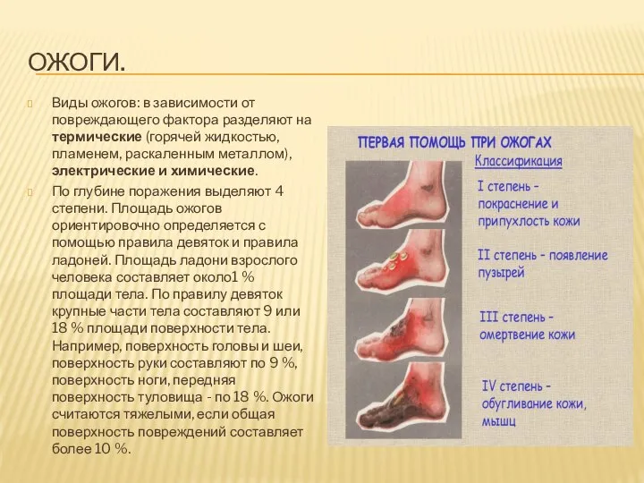 Ожоги. Виды ожогов: в зависимости от повреждающего фактора разделяют на термические