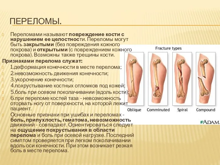 Переломы. Переломами называют повреждение кости с нарушением ее целостности. Переломы могут