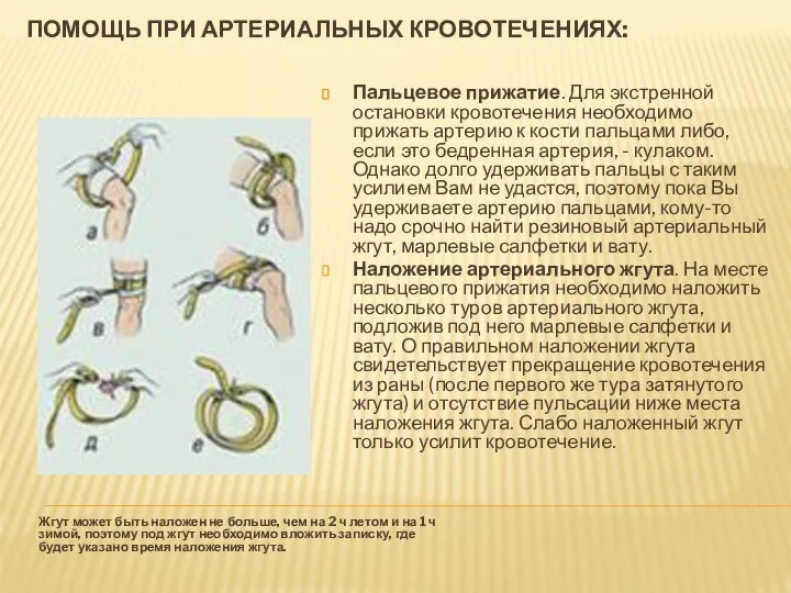 Помощь при артериальных кровотечениях: Жгут может быть наложен не больше, чем