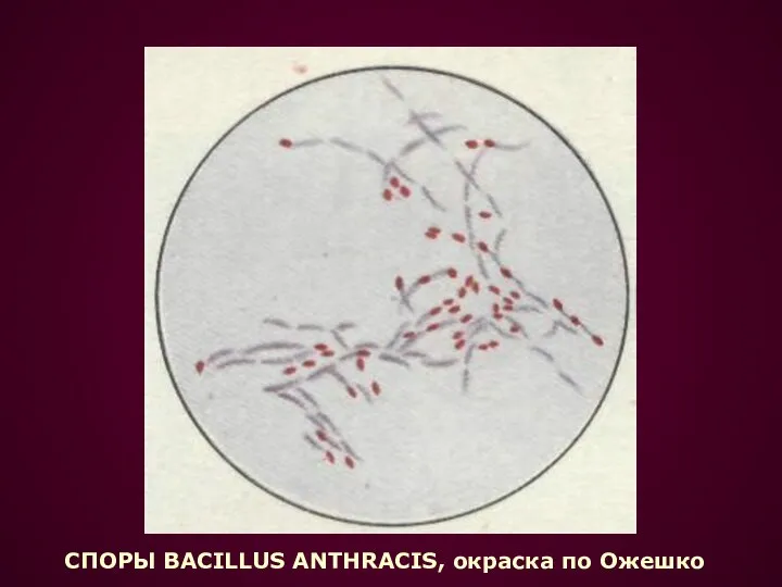 СПОРЫ BACILLUS ANTHRACIS, окраска по Ожешко