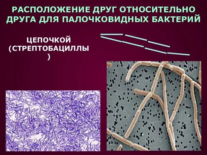 РАСПОЛОЖЕНИЕ ДРУГ ОТНОСИТЕЛЬНО ДРУГА ДЛЯ ПАЛОЧКОВИДНЫХ БАКТЕРИЙ ЦЕПОЧКОЙ (СТРЕПТОБАЦИЛЛЫ)