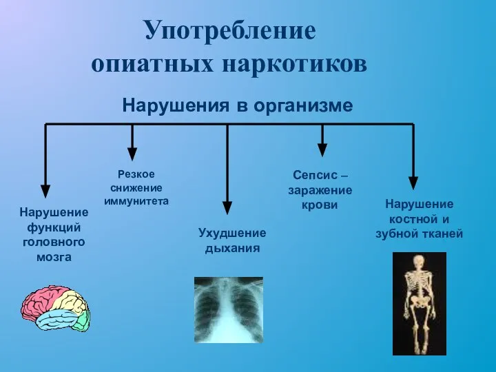 Употребление опиатных наркотиков Нарушение функций головного мозга Нарушение костной и зубной