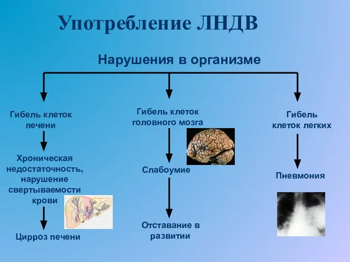 Употребление ЛНДВ Гибель клеток печени Хроническая недостаточность, нарушение свертываемости крови Цирроз