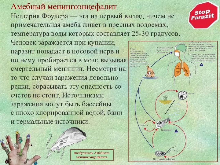 Амебный менингоэнцефалит. Неглерия Фоулера — эта на первый взгляд ничем не