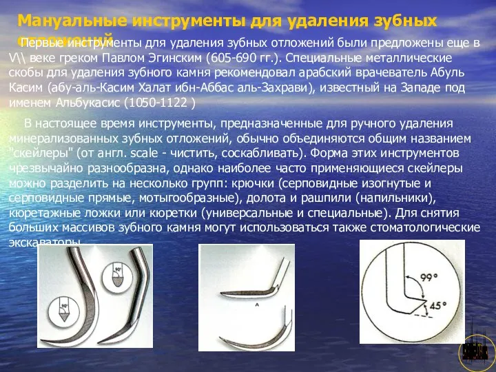 АНИСИМОВА Л.В.кмн. Мануальные инструменты для удаления зубных отложений Первые инструменты для