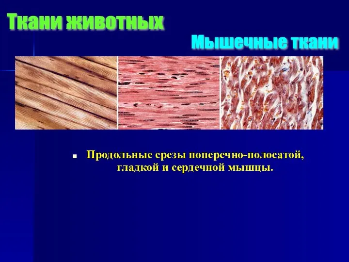 Продольные срезы поперечно-полосатой, гладкой и сердечной мышцы. Мышечные ткани Ткани животных