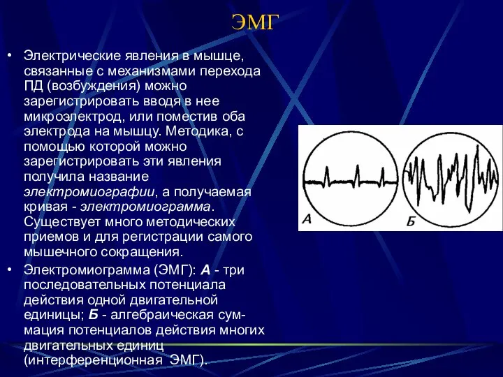 ЭМГ Электрические явления в мышце, связанные с механизмами перехода ПД (возбуждения)