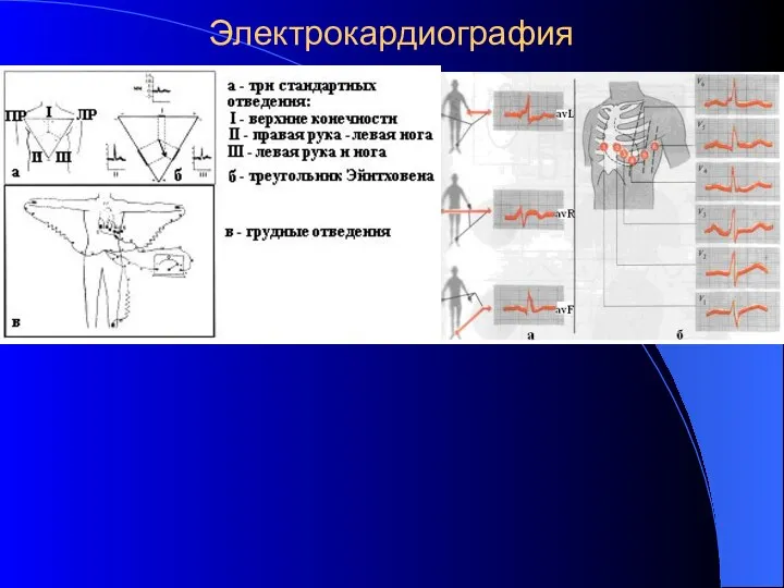 Электрокардиография