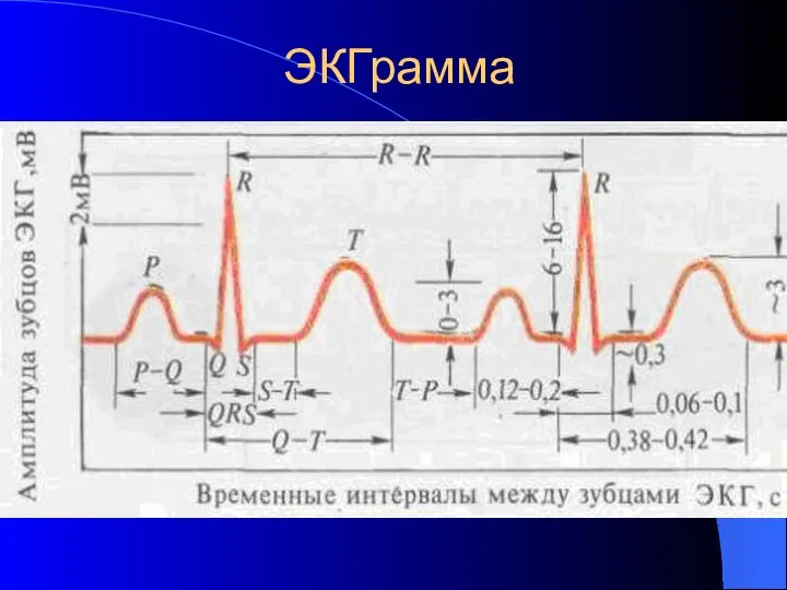 ЭКГрамма