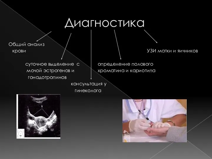 Диагностика Общий анализ крови УЗИ матки и яичников суточное выделение с