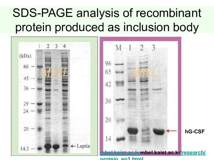 SDS-PAGE analysis of recombinant protein produced as inclusion body hG-CSF mbel.kaist.ac.krmbel.kaist.ac.kr/research/ protein_en1.html