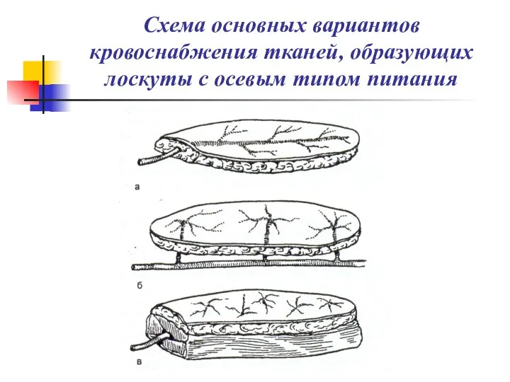 Схема основных вариантов кровоснабжения тканей, образующих лоскуты с осевым типом питания