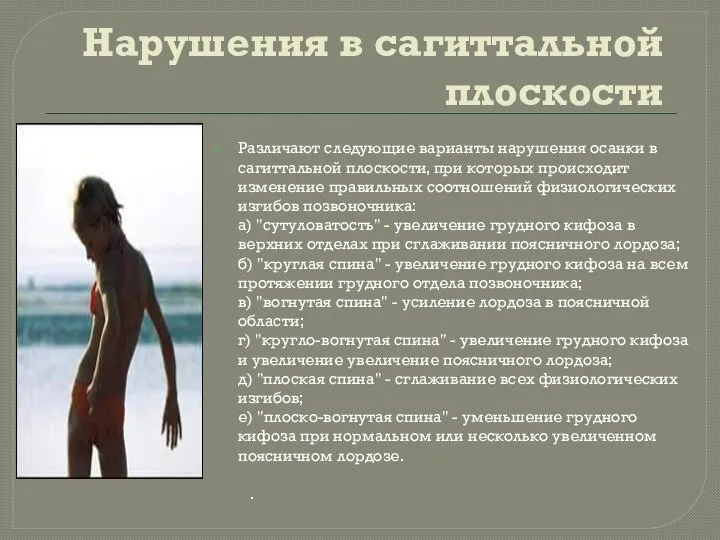 Нарушения в сагиттальной плоскости Различают следующие варианты нарушения осанки в сагиттальной