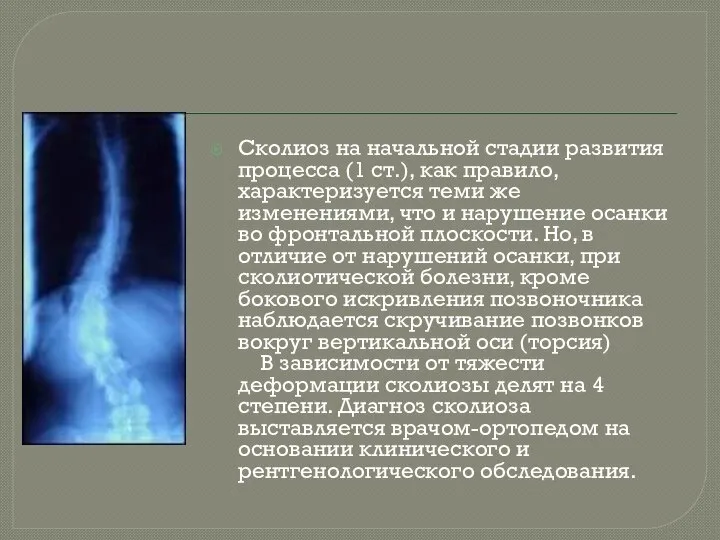 Сколиоз на начальной стадии развития процесса (1 ст.), как правило, характеризуется