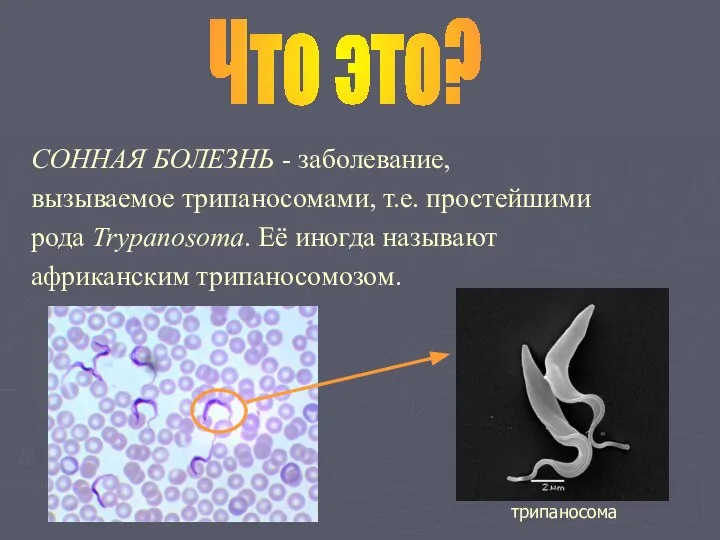 СОННАЯ БОЛЕЗНЬ - заболевание, вызываемое трипаносомами, т.е. простейшими рода Trypanosoma. Её