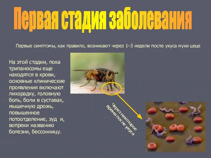 Первые симптомы, как правило, возникают через 1–3 недели после укуса мухи