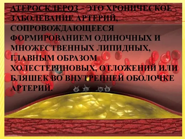 Атеросклероз – это хроническое заболевание артерий, сопровождающееся формированием одиночных и множественных