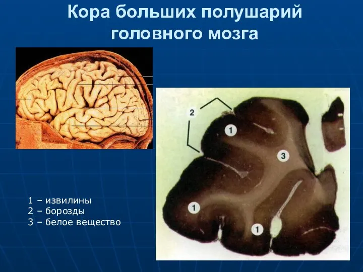 Кора больших полушарий головного мозга 1 – извилины 2 – борозды 3 – белое вещество