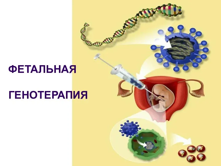 ФЕТАЛЬНАЯ ГЕНОТЕРАПИЯ