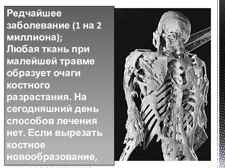 Редчайшее заболевание (1 на 2 миллиона); Любая ткань при малейшей травме