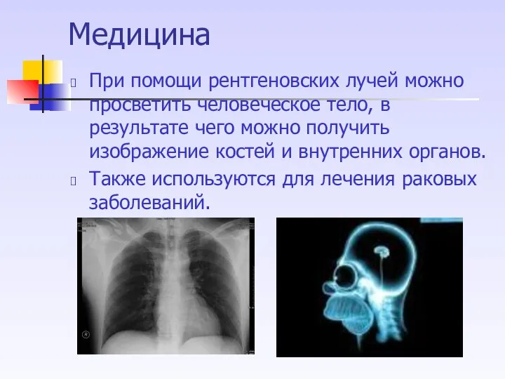 Медицина При помощи рентгеновских лучей можно просветить человеческое тело, в результате