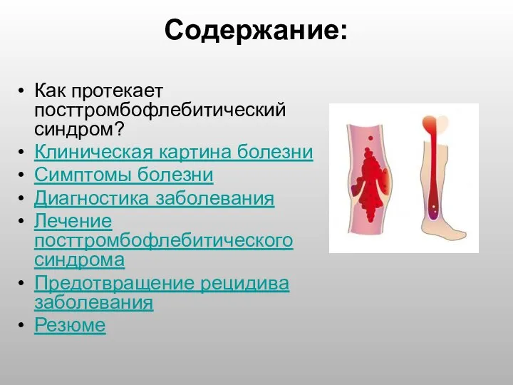 Содержание: Как протекает посттромбофлебитический синдром? Клиническая картина болезни Симптомы болезни Диагностика