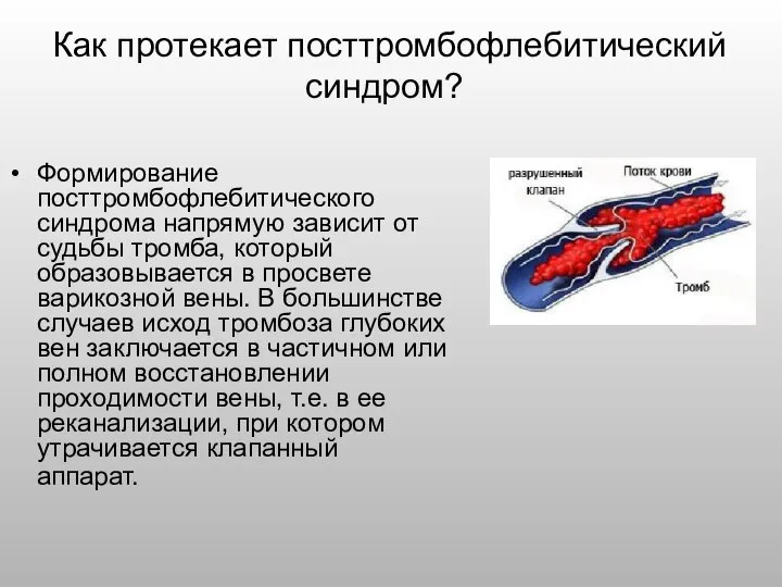 Как протекает посттромбофлебитический синдром? Формирование посттромбофлебитического синдрома напрямую зависит от судьбы