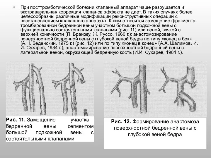 При посттромботической болезни клапанный аппарат чаще разрушается и экстравазальная коррекция клапанов