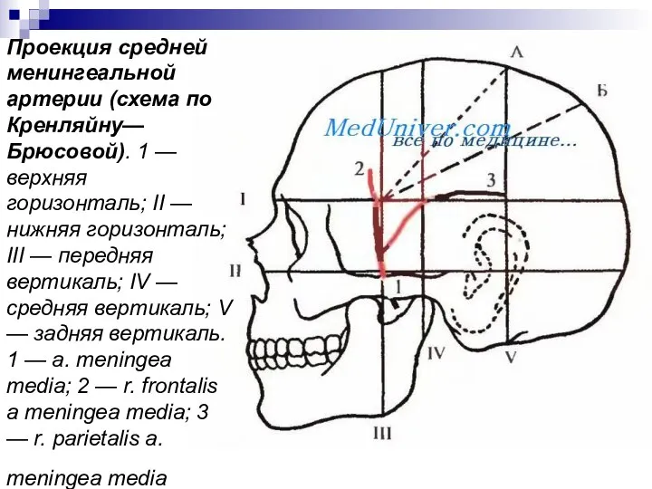 Проекция средней менингеальной артерии (схема по Кренляйну—Брюсовой). 1 — верхняя горизонталь;