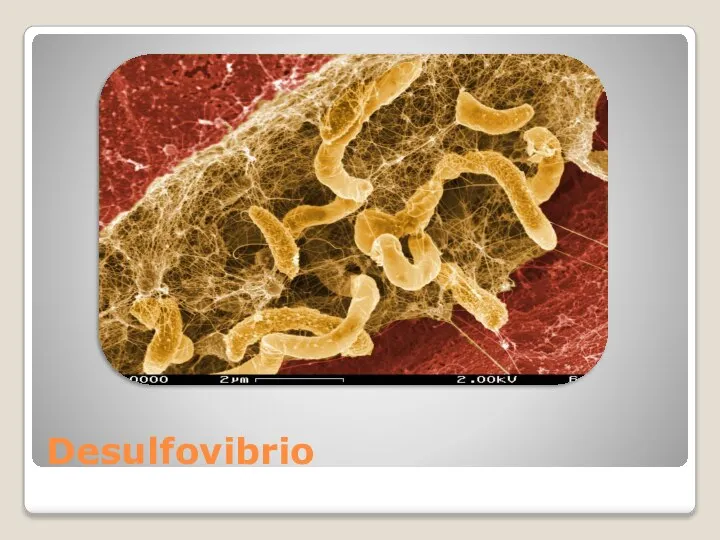 Desulfovibrio