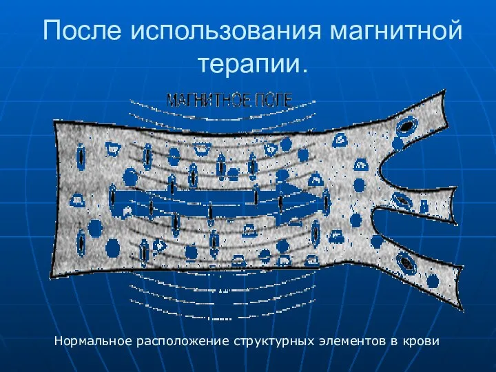 После использования магнитной терапии. Нормальное расположение структурных элементов в крови