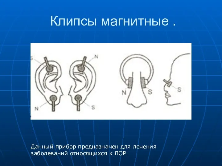 Клипсы магнитные . Данный прибор предназначен для лечения заболеваний относящихся к ЛОР.