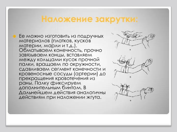 Наложение закрутки: Ее можно изготовить из подручных материалов (платков, кусков материи,