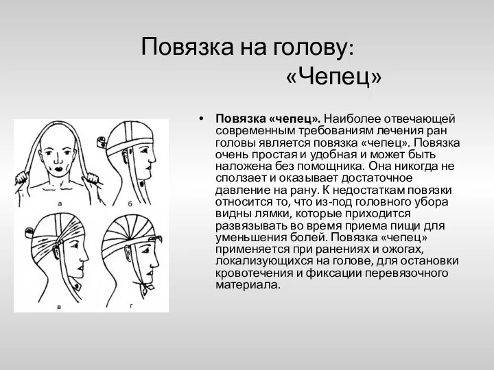 Повязка на голову: «Чепец» Повязка «чепец». Наиболее отвечающей современным требованиям лечения