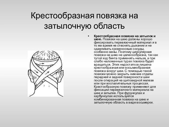 Крестообразная повязка на затылочную область Крестообразная повязка на затылок и шею.