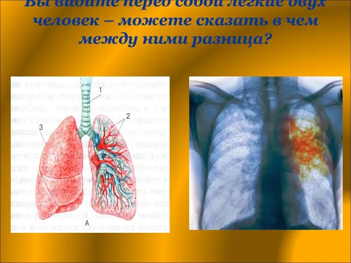 Вы видите перед собой легкие двух человек – можете сказать в чем между ними разница?