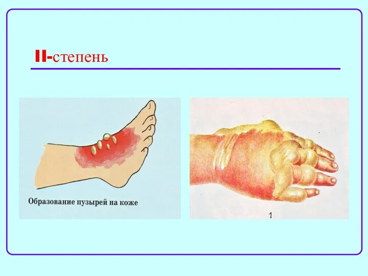 II-степень