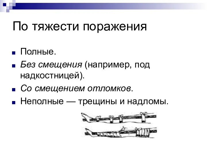 По тяжести поражения Полные. Без смещения (например, под надкостницей). Со смещением