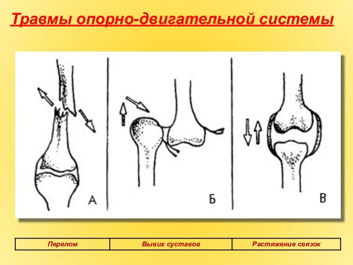 Травмы опорно-двигательной системы